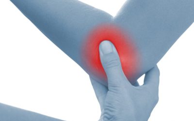 Rheumatoid Arthritis Part 3